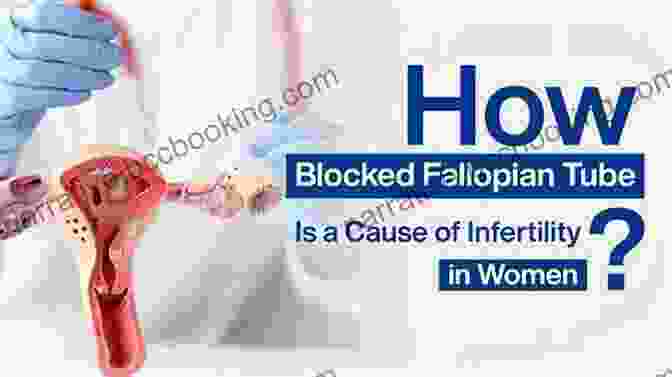 Blocked Fallopian Tubes Beyond Infertility: 48 Reasons Why You Are Not Yet Pregnant