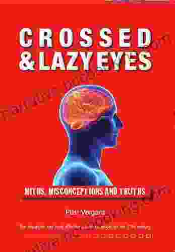 Crossed And Lazy Eyes: Myths Misconceptions And Truths